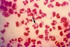 of <b>Neisseria gonorrhoeae</b>,