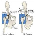 Hip Dysplasia and Arthritis in Dogs are NOT the same thing