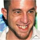 Celebrities with Bad Teeth!