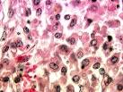 While the diagnosis of R. <b>equi</b>