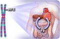 <b>hemochromatosis</b>.jpg