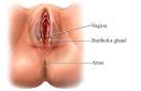White Bumps On Vaginal Lips And Discharge - Doctor answers on ...