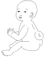 <b>Spina bifida</b>