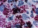 "<b>Mycobacterium leprae</b>.