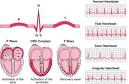 ECG