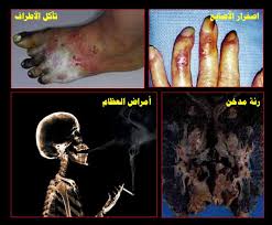 صور عن الدخان من تجميعي.. 
