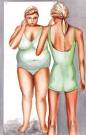 Uncategorized|anorexia nervosa symptoms and treatments|Home Health ...