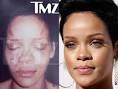 Alleged Rihanna Abuse Photo