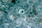la <b>dissenteria amebica</b> e'