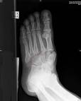 The Foot