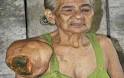 KOMPAS.com — Derita yang dialami Nek Hamidah Abdullah (65) di Gampong ... - nenek