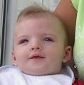ahsmediacenter / Characteristics of Cri du Chat Syndrome 3