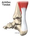 The Achilles Tendon Injury - Conquest Chronicles