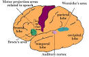 <b>Broca's Aphasia</b>