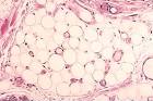 Adipose Tissue Color Images