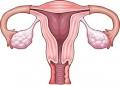 Ovarian Cyst Signs - Symptoms of Cysts on Ovaries