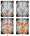 11.20.00 - Nation's most powerful brain scanner devoted solely to ...
