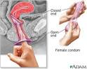 The female condom - Shands Healthcare