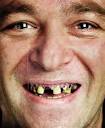 I'm a stickler about teeth!