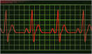 Pulse
