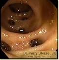W. Perry Stokes, Jr., M.D., F.A.C.G.