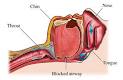 Sleep Apnea Study | Obstructive Sleep Apnea | Central Sleep Apnea