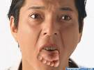 Foot in Mouth Syndrome,
