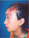 之后与警察来