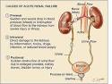 Images related to Acute Kidney Failure
