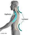 spine is called <b>lordosis</b>.
