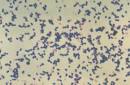 Gram-positive cocci and Gram-negative cocci