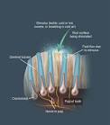 <b>Dentine hypersensitivity</b>