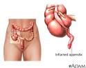 HowStuffWorks "Other Appendix Conditions"