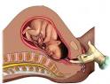 <b>Umbilical cord</b> prolapse is