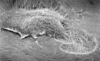 Bone Marrow - nonneoplastic - <b>Osteoclasts</b>