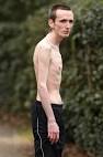 VIDEO: Manorexic Marc Corn- An Anorexic Man Story (Photos, pics, bio)