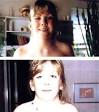 Turner syndrome - Wikipedia, the free encyclopedia