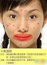 唇周痘VS肠
