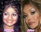 Fresh Pics  16 Worst Celebrity Plastic Surgery Disasters