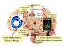New Hope For Alzheimer's Patients