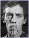 Ante Bozanich wrote: I think the first step would be awareness and admission