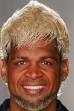 Q. Does Abel Xavier's hair get