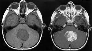 external image images?q=tbn:ANd9GcQrbftMPWsDhZ58c1jt0STqkiq9hDOWaiR7zbC5vezhiZqQz0Kd