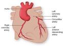 Coronary Artery Disease - Texas Heart Institute Heart Information ...