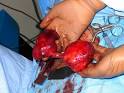 red pancake disease pictures
