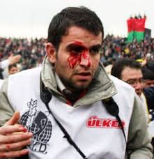 Mehmet Kayahan yaralandı- - 211070_detay