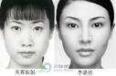 芙蓉姐姐变李嘉欣的疯狂整形