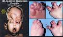 How To Spot &amp; Prevent Drug Abuse In Pregnant Women