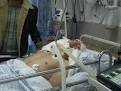 Young man in critical condition after being shot three times in ...