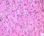 <b>epithelioid cells</b>